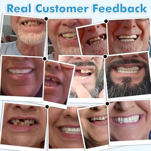 Clip On Veneers for Men & Women - [3 Shades & 2 Styles] Custom Fit Temporary Smile Accessory, Natural Cosmetic Teeth Covers, Reusable Personalized Upper and Lower Veneers Set (Top + Bottom)
