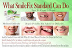 SmileFix Standard Dental Repair Kit - Color Matching Compound - For Missing Or Damaged Teeth - Fix Gaps, Broken Tooth, Spaces - Durable Repair - Fast & Easy - Confident Smiles