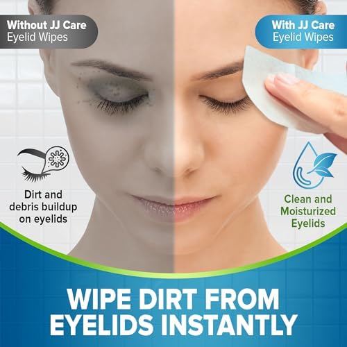 JJ CARE Eyelid Cleaning Wipes - Box of 80, 4"x4" Individually Wrapped Moisturizing Eye Lid Scrubbing Wipes for Irritated, Itchy, and Dry Eyes, Hypoallergenic Eye Scrub & Eyelashes cleaning Pads