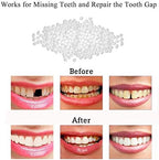 Tooth Repair Kit-Thermal Beads for Filling Fix The Missing and Broken Tooth or Adhesive The Denture Fake Teeth
