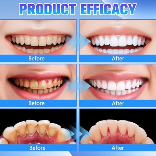 2Pack Tooth Relief for Adults Spray - Soothes Gum Fast, Improves Dryness, Portable Oral Care for Adults, Freshens Breath, Mint & Chamomile Formula