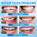 Tooth Repair Kit, Moldable False Teeth Beads, DIY Temporary Tooth Replacement Kit, Suitable for Missing, Broken and Chipped, Tooth Repair Beads Make You Smile Confidently-1PC
