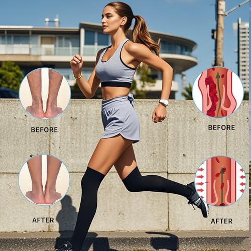 20-30 mmHg Compression Stockings for Women & Men, Thigh High Compression Socks Open Toe, Silicone Dot Band