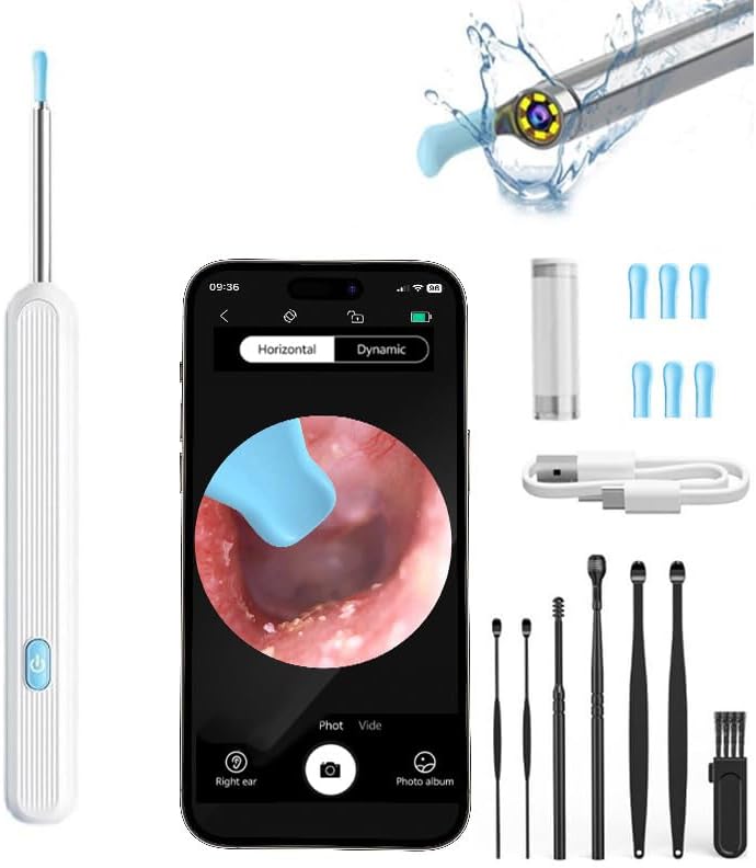 Ear Wax Removal Tool Camera Kit with 1080P HD Camera,6 LED Strong Light WiFi Connection, Ear Cleaner Removal for Precise Earwax Cleaning iOS & Android System (Mixed Black&White)