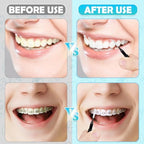 MAPVOLUT 120 Pieces Interdental Brushes, Braces Brush Cleaner Orthodontic Flossers Toothpicks Floss Picks for Braces Kit for Teeth Cleaning Tools Spiral Dental Brush Head for Efficient Oral Care Black