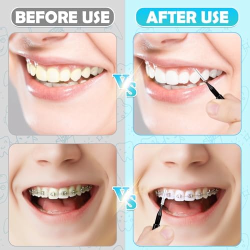MAPVOLUT 120 Pieces Interdental Brushes, Braces Brush Cleaner Orthodontic Flossers Toothpicks Floss Picks for Braces Kit for Teeth Cleaning Tools Spiral Dental Brush Head for Efficient Oral Care Black