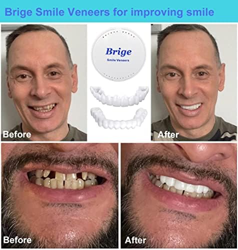 Brige Smile Teeth Denture Temporary False Teeth Improve Smile