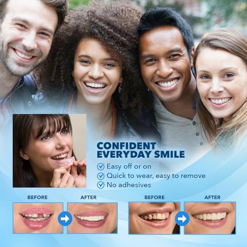 Imako Premium Cosmetic Uppers for Men and Women – Temporary Smile Makeover – 1 Pack Small, Natural White – Made in USA