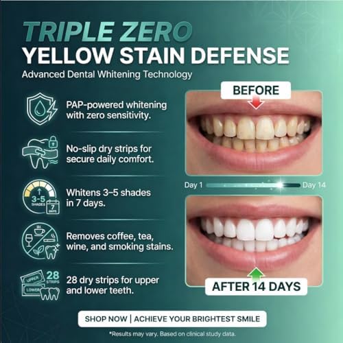 Premium Teeth Whitening Strips for Sensitive Teeth, 28 Strips, 14 Day At Home Stain Remover Pap Peroxide Free Non-Slip Dry Strips, Enamel Safe Whitening Kit, Winter Mint Flavor