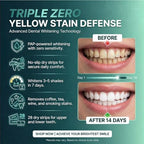 Premium Teeth Whitening Strips for Sensitive Teeth, 28 Strips, 14 Day At Home Stain Remover Pap Peroxide Free Non-Slip Dry Strips, Enamel Safe Whitening Kit, Winter Mint Flavor