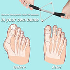 Tondiamo Pilates Toe Stretcher Bunion, Hallux Valgus Big Toe Strap Spacer Tension Bunion Exercise Band Stretchy Alignment Splint Restores Pain Relief for Women Men