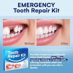 Temporary Tooth Repair Kit: Missing Tooth Replacement Kit Replace Missing or Broken Tooth Filling The Gap - Moldable False Teeth Come with 3 Shades 10 Size