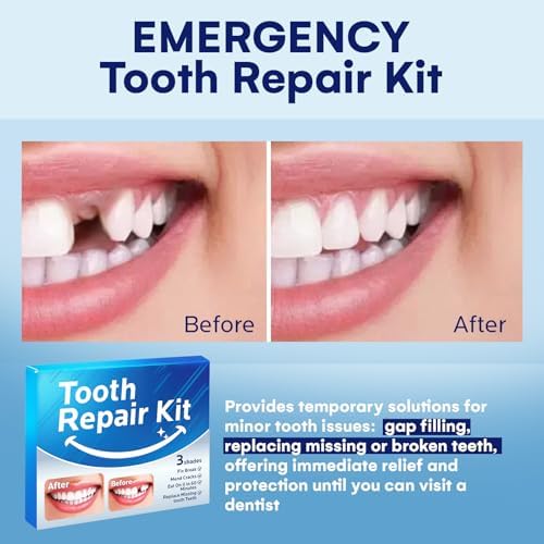 Temporary Tooth Repair Kit: Missing Tooth Replacement Kit Replace Missing or Broken Tooth Filling The Gap - Moldable False Teeth Come with 3 Shades 10 Size
