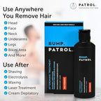 Bump Patrol Maximum Strength Aftershave Treatment Serum – Razor Bump Stopper and Ingrown Hair Treatment for Men and Women, Fast Acting Formula - 2 oz (Pack of 4)
