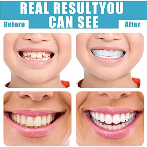 Instant Veneers Dentures Fake Teeth Smile Teeth Veneer Top and Bottom False Teeth Veneers Snap in Teeth Temporary Cosmetic Teeth for Women and Men Cover Imperfect Teeth Regain Confidence Smile