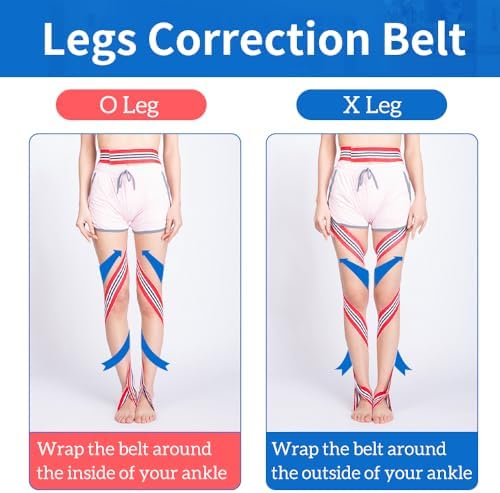 GHORTHOUD O/X Legs Correction Belt Legs Posture Corrector Band Unisex O/X Legs Bandage Lightweight Pediatric Straighten Belt for Men Women and Children（Large）