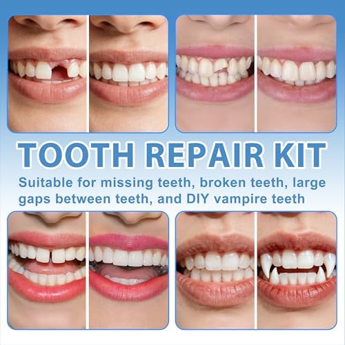 XLMCWT Tooth Repair Kit, Moldable False Teeth Beads for Teeth Repair, Suitable for Missing, Cracked DIY Denture Kit, 1PCS