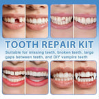 XLMCWT Tooth Repair Kit, Moldable False Teeth Beads for Teeth Repair, Suitable for Missing, Cracked DIY Denture Kit, 1PCS