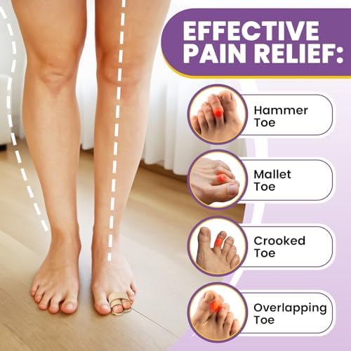 JUMPOW Hammer Toe Straightener - Broken Toe Wraps,Hammer Toe Corrector for Women & Men, 2 Pcs Toe Splint Relief for Correcting Hammer Toes, Broken Toes, Crooked Toes & Overlapping Toes (Beige)