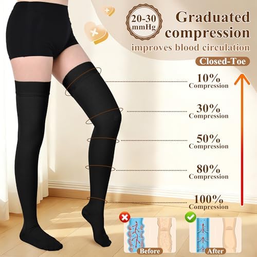 Athbavib 20-30mmHg Thigh High Compression Stockings for Women & Men, Closed Toe Medical Compression Socks Graduated Support Compression Sock for Varicose Veins Swelling Treatment