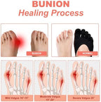 Women's 4 Pairs Orthopedic Toe Compression Socks, Toe Separator Socks for Bunion, Low Cut Liner Five Finger Socks Size 6-9 (Black)