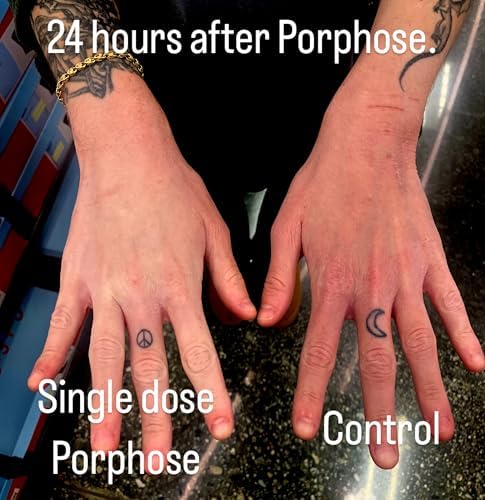 Porphose Eczema Relief Spray for Kids and Adults | OTC Skin Protectant with Red Algae + Colloidal Oatmeal | Steroid-Free, Fragrance-Free, Pediatrician-Tested | 1 fl oz