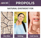 Propolis Ointment, Natural 30% Propolis Ointment for Itchy, Dry and Cracked Skin, 1.35 fl oz