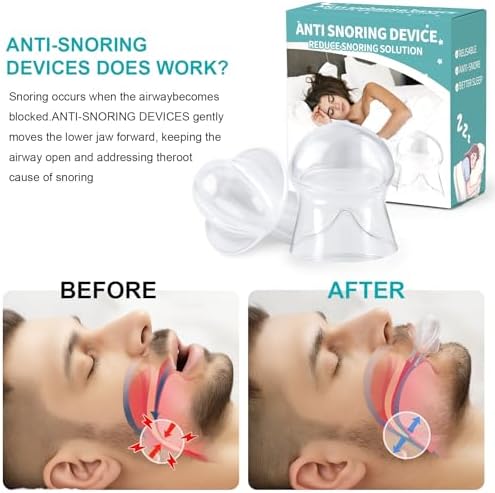 Anti Snoring Device - Snoring Solution Mouth Guard for Men and Women -VV06