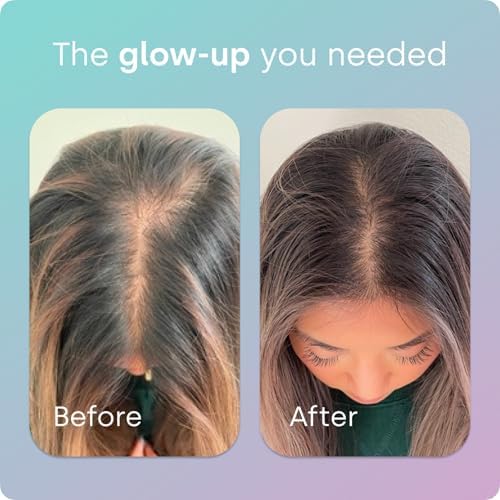 Biosil Advanced Hair + Nail Care - 60 Capsules - Grow, Strengthen & Thicken Hair and Nails - with Patented ch-OSA & Biotin - 30-Day Supply