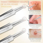 Teenitor 4 Pcs Professional Blackhead Tweezers and Pimple Popper Tool Kit, Stainless Steel Cell Tweezers for Blackhead, Pimple, Whitehead, Ance