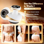 Vacuvia Cellulite Remove Massage Tool Suction,Electric Cupping Massager 9 Suction Levels&Heat,Rechargeable Vacuum Anti Cellulite Massager for Lymphatic Drainage,Body Contouring&Skin Firming (Gold)