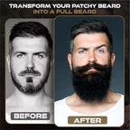 Beardilizer ® Beard Oil Collection - #4 Tea Tree Trance 4 Oz - Made with 100% Natural Ingredients