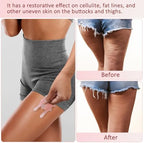 AICNLY Large Fascia Massage Blaster Tool for Cellulite– Deep Tissue Cellulite Roller for Lymphatic Drainage, Circulation Boost, Muscle Release, Myofascial Release&Trigger Points