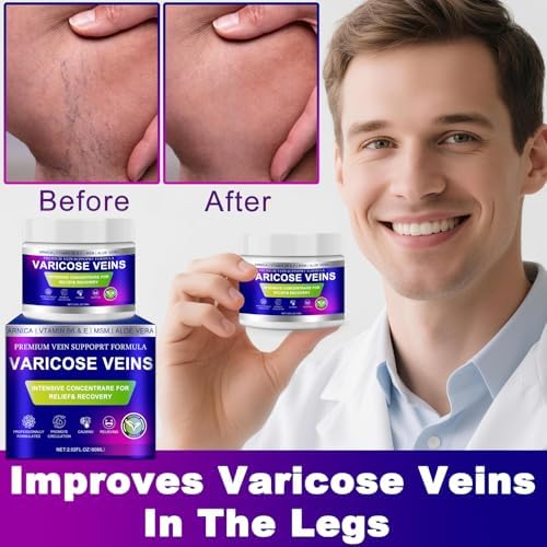 Varicose Veins Cream, Vein Cream & Spider Veins Treatment for Legs, Improves Blood Circulation and Relief From Heavy Fatigued Leg, Refreshing and Non-Sticky, 1Pack