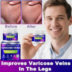 Varicose Veins Cream, Vein Cream & Spider Veins Treatment for Legs, Improves Blood Circulation and Relief From Heavy Fatigued Leg, Refreshing and Non-Sticky, 1Pack