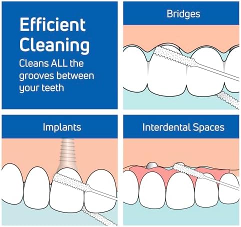 TePe Bridge and Implant Floss for Dental Implants, Bridges, and Braces, Dental Flossers, 30 Pieces