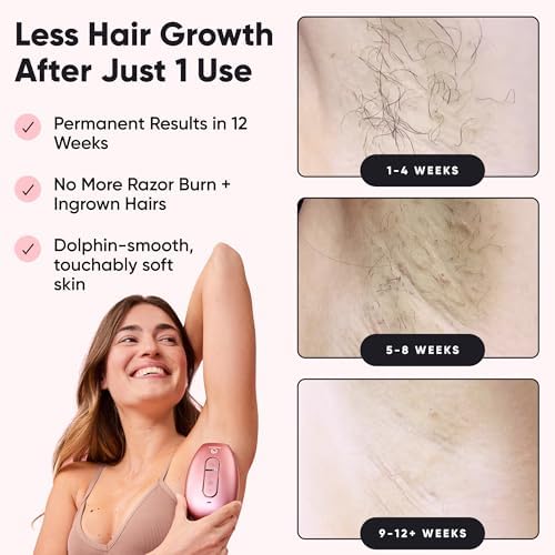 RoseSkinCo Lumi IPL Laser Hair Removal Device, At Home Permanent Hair Reduction on Face, Bikini, Legs, Arms, Underarms, Safe & Gentle Intense Pulsed Light Handheld Device, Rose/Gold