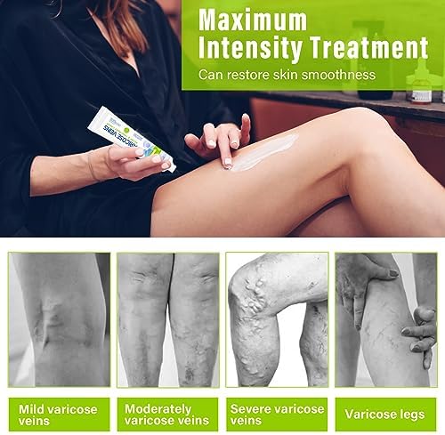 Varicose Veins Treatment for Legs, Varicose Veins Cream to Treat Varicose, Spider Veins & Improves Circulation, Protect Vascular Health, 20g