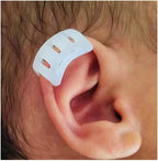 Infant Lop Ear Deformity Correction Clip For Newborn Baby, Fixing Auricle Valgus Patch Stickers Children Ear Shape Aesthetic Corrector Without Surgery