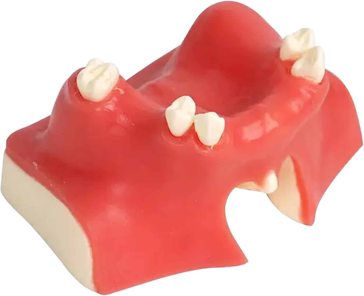 Dental Tooth Model Teeth Typodonts Dental Implant Maxillary Sinus Model Lift Practice Model for Training Teaching Demo and Study