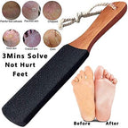 Kinepi Foot Scrubber Pedicure Foot File Pumice Stone,Professional Pedicure Supplies Callus Remove Cracked Heels,Dead Skin,Corn,Scraper File Foot Care Foot Rasp Massage Brush Tools Kit for Men/Women