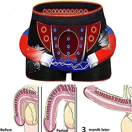 POCHY 3-Packs Men's Underwear Tourmaline Prostate Enlargement Therapy Magnetic Boxer Briefs Health Care Inner Pants (Color : 3PCS-Black, Size : Large)