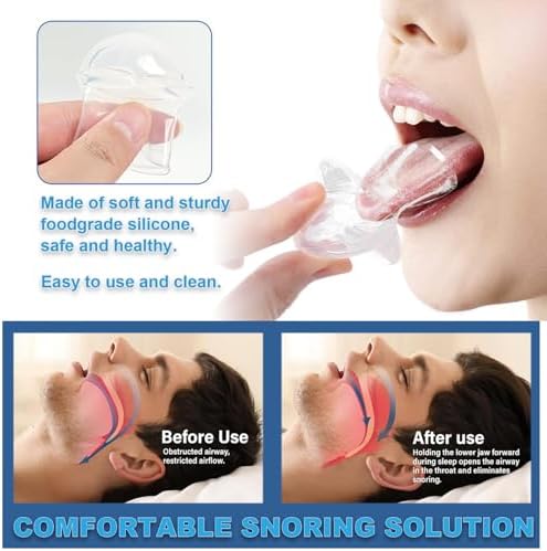 Tongue Stabilizing Device Mouthpiece - Anti-Snore Device, Reusable Snore Solution Stopper for Men/Women - MF88