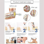 Extracorporeal Shockwave Therapy Machine, ED Shock Wave for Erectile Dysfunction & Treatment and Relieve Pain with 7 Massage Heads