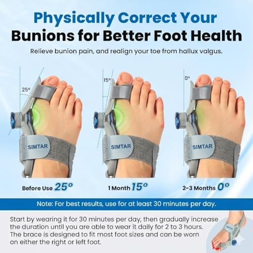SIMTAR Premium Adjustable Bunion Corrector for Woman – Big Toe Valgus Brace & Support Device Left & Right Foot Night Splint bunion fix without surgery