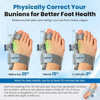 SIMTAR Premium Adjustable Bunion Corrector for Woman – Big Toe Valgus Brace & Support Device Left & Right Foot Night Splint bunion fix without surgery