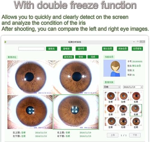 Iridology Camera, Iris Analysis Camera Eye Iridology Camera Led Illuminator Auto Eye Iridology Camera with Professional Software