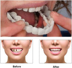 2 Pairs Adjustable Smile Veneers, Natural-Looking Comfort for Men and Women (Natural White1)