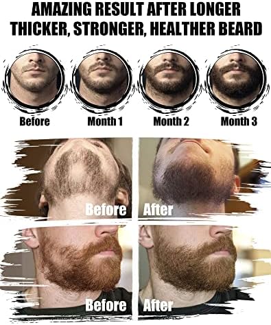 Beard Kit for Men Grooming & Care: with 2 Pack Beard Oils and Balm - Wash & Conditioner for After Shave Lotions Sandalwood, Brush and Comb Sets with Scissors, Valentines Fathers Gifts for Dad/Men/Him