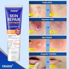 TAGRID Skin Repair Ointment (1 Oz) for Ingrown Hair, Folliculitis, Boils, Angular Cheilitis, Lichen Sclerosis, Impetigo, and Pitted Keratolysis Treatment - Maximum Strength Antifungal Cream